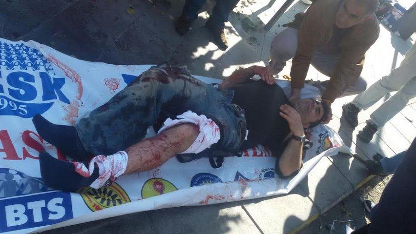 Ankara'da patlama oldu