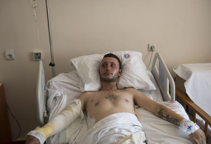 Patlamada yaralanan genç o anları anlattı