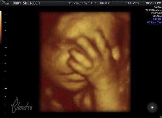 Yolanthe Cabau anne oldu