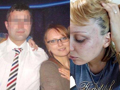 Batmanlı eski eşinden şiddet gören Azeri kadının isyanı