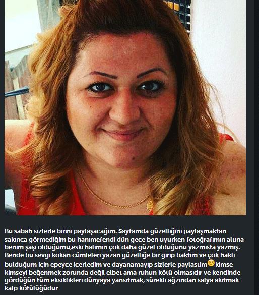 Deniz Akkaya takipçisini rezil etti