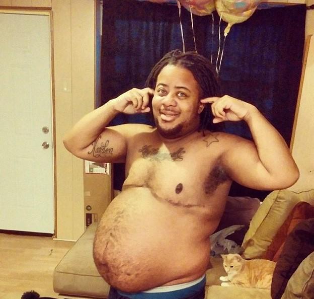 Transeksüel adam hamile kaldı