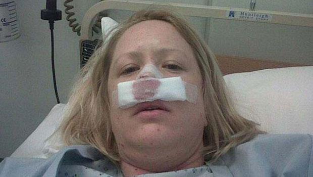 Hapşırdı burun kemiği elinde kaldı