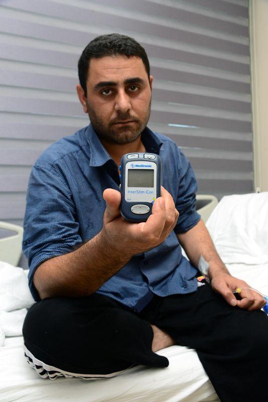 Türk cerrah mayına basan peşmergeye pilli makat yaptı