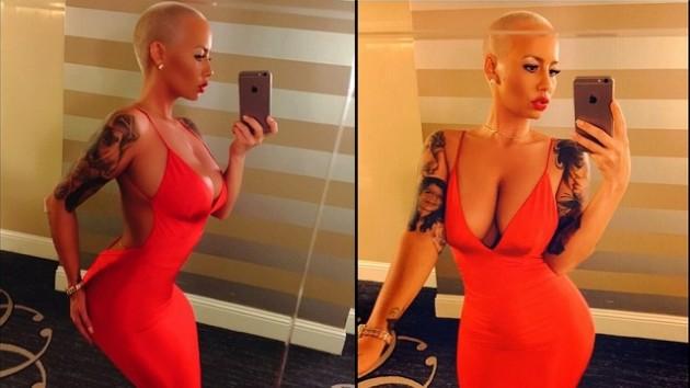 Amber Rose'un kalçasında dolgu olduğu ortaya çıktı