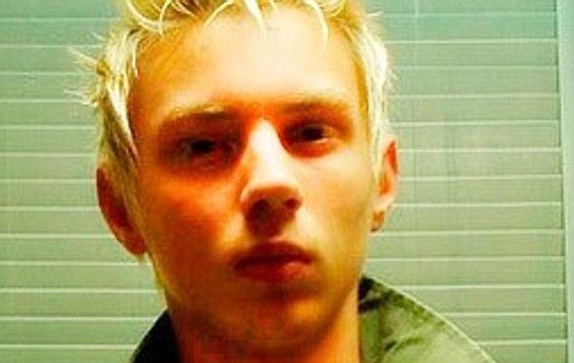 Asyalılara benzemek için 10 ameliyat geçirdi