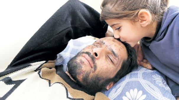 Suriyeli kız: Gözlerimi alıp babama verin