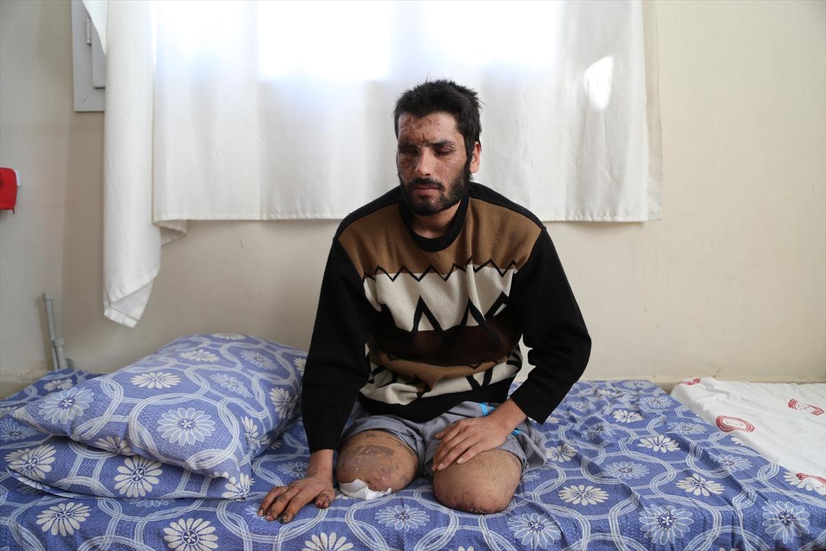 Suriyeli kız: Gözlerimi alıp babama verin