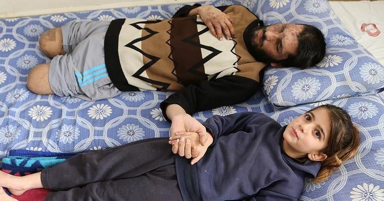 Suriyeli kız: Gözlerimi alıp babama verin