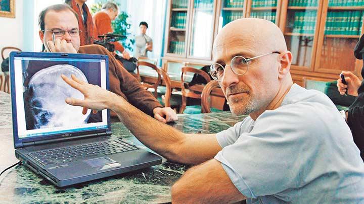 Maymuna kafa nakli yapıldı