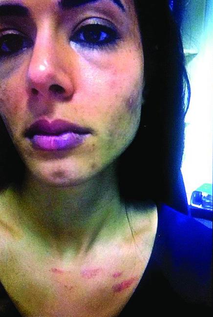 İbrahim Toraman eşini dövdü