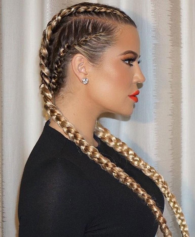 Khloe Kardashian estetiği abarttı