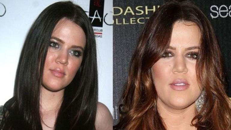 Khloe Kardashian estetiği abarttı