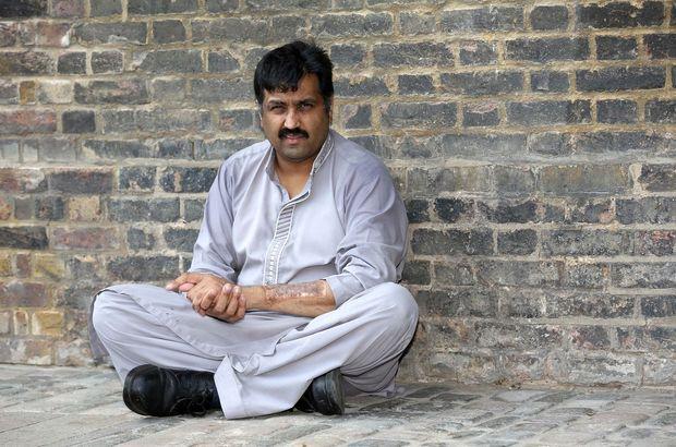 Yapay penisli adam ilk deneyimini yaşadı