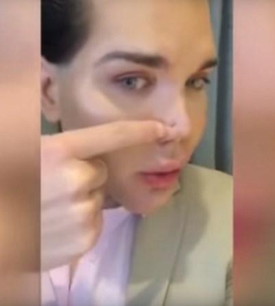 Barbie adamın estetik yüzünden burnu çürüdü