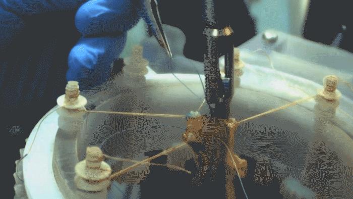 Robot cerrahtan bağırsak ameliyatı