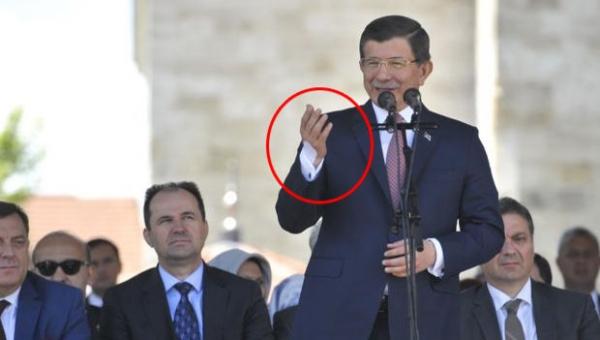 Davutoğlu'nun eli tokalaşmaktan incindi