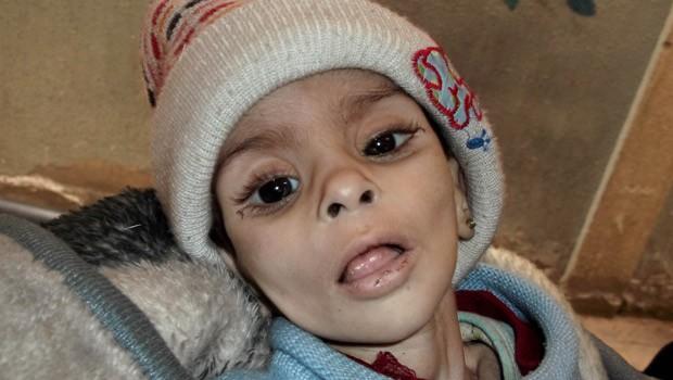 Yermuk kampından kaçan kadın: İnsanlar kedi yiyordu