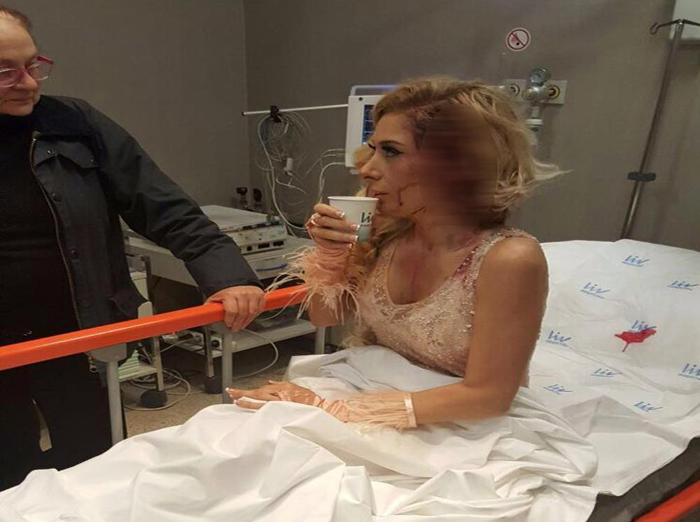 Şarkıcı Selen'in kafasına dekor düştü
