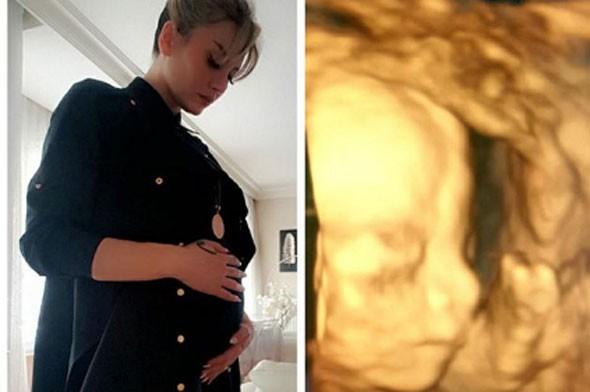 İsmail Hacıoğlu baba oluyor