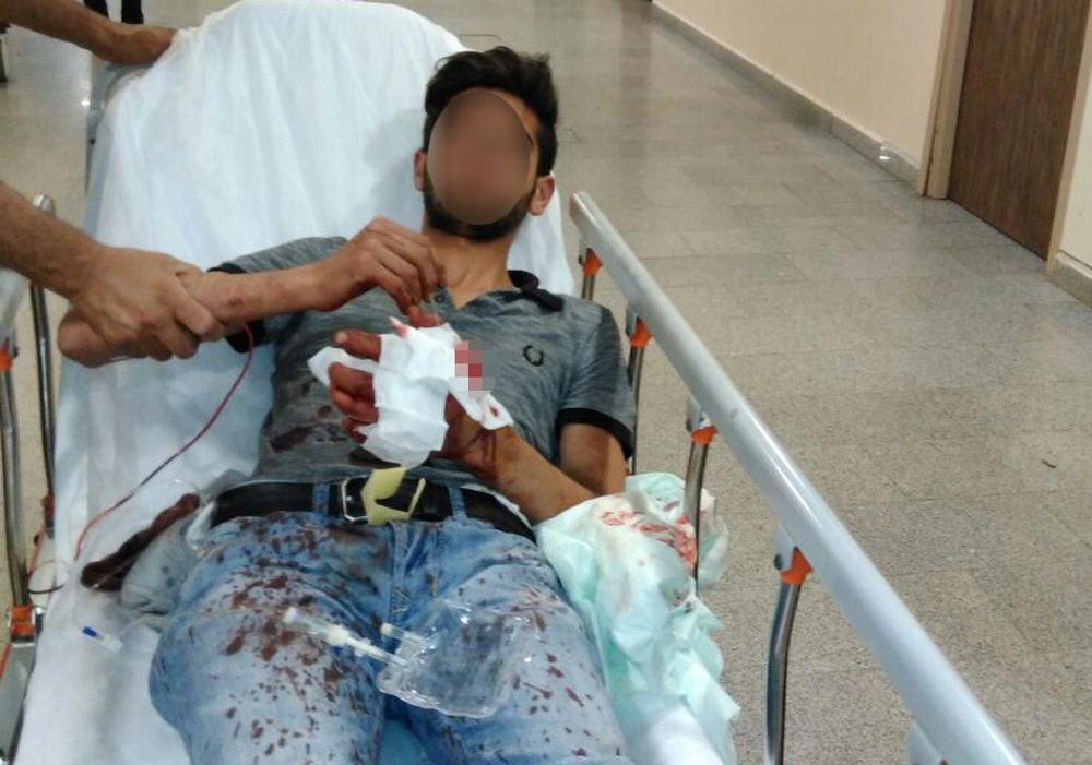 Pendik'te elinde bomba patlayan terörist yakalandı
