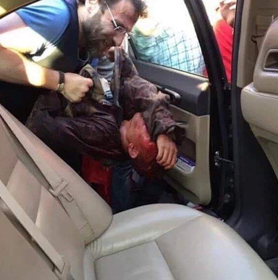 Askerin kafası kesildi iddialarını yalanlayan fotoğraf