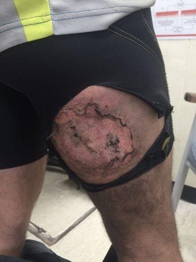 iPhone'u arka cebinde eridi