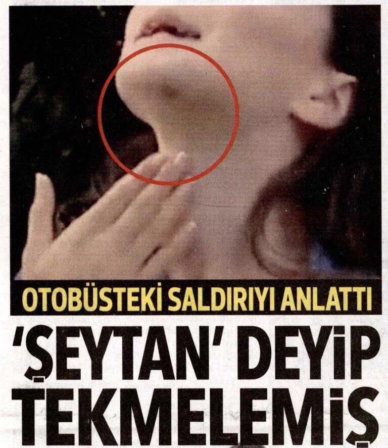 Hürriyet ve Birgün'ün 'Şort giydi dayak yedi' haberi