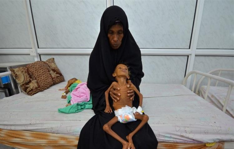 Yemen'de binlerce çocuk açlığın pençesinde