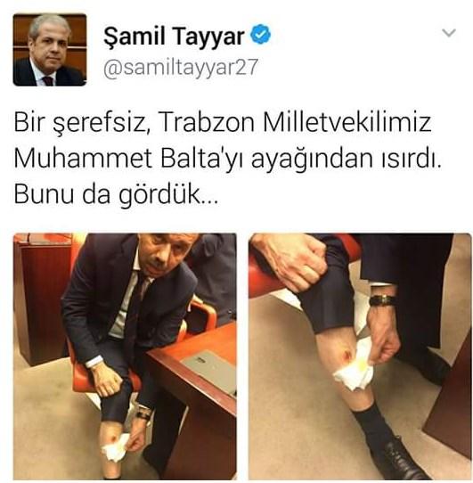 Eren Erdem AK Partili vekili bacağından ısırdı