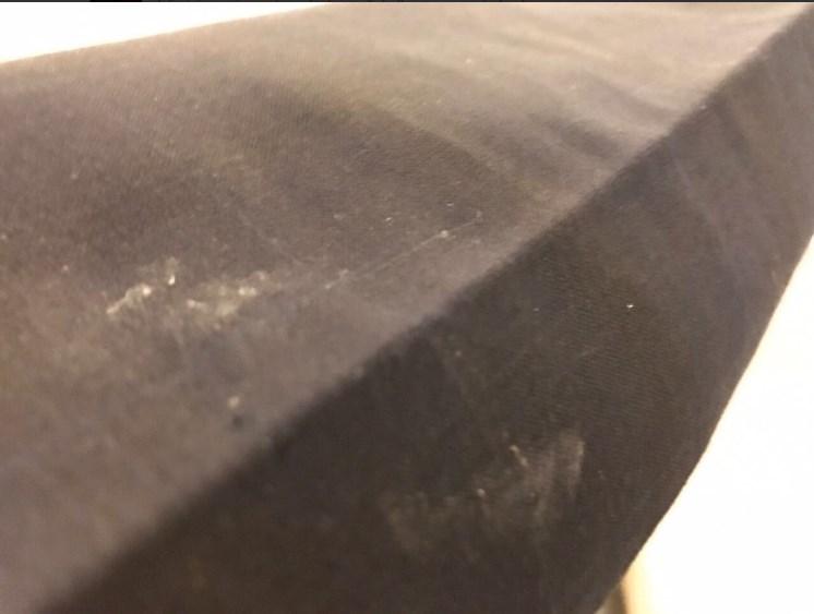 Eren Erdem AK Partili vekili bacağından ısırdı