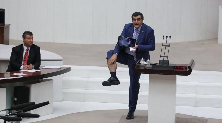 CHP'li Ali Şeker vekillere bacağını açtı