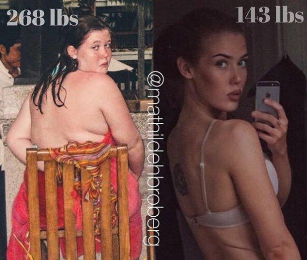 Mathilde Broberg'in zayıflama hikayesi