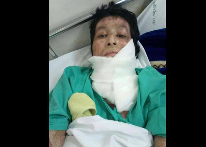 Tayland'da kıskanç koca eşini yaktı