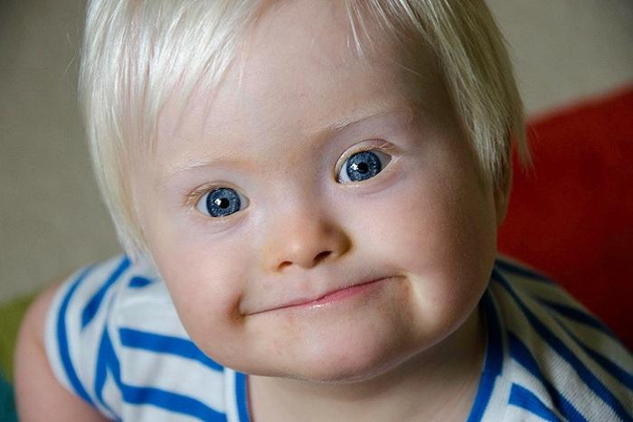 Dünya Down Sendromu Günü