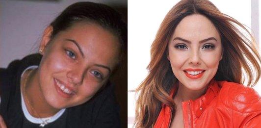 Ebru Gündeş: Yüzümde estetik yok