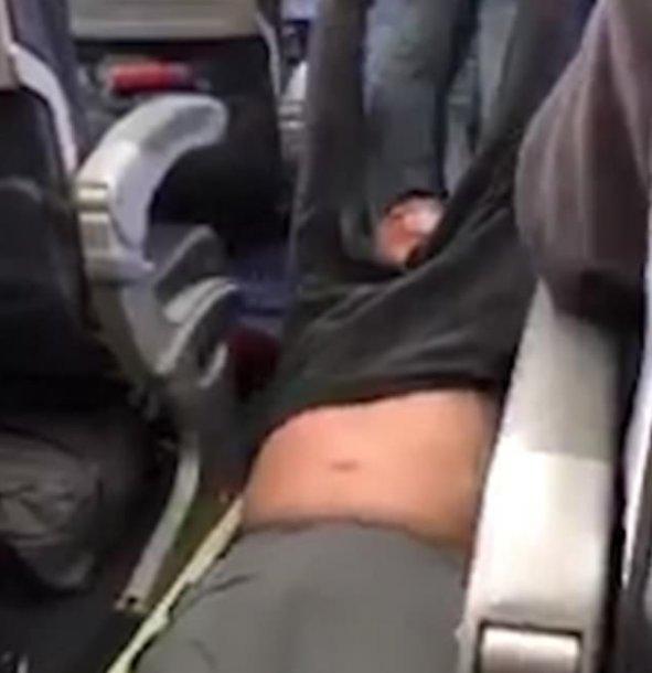 Darp edilen United Airlines yolcusu iki avukat tuttu