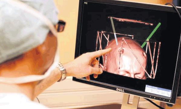 Bilim insanları beyin üretti