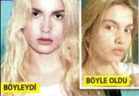 Zehra gecelerde, Aleyna Tilki estetik yaptırdı