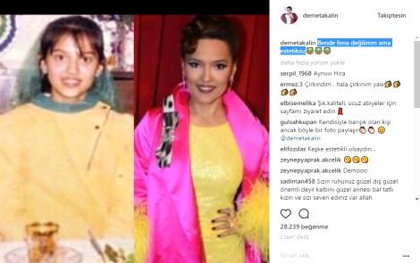 Demet Akalın estetiksiz fotoğrafını paylaştı