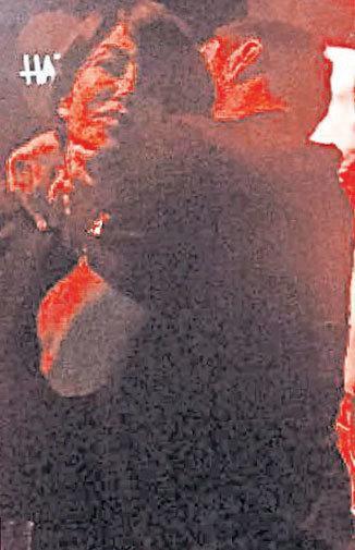 Deniz Akkaya'ya saldırıya uğradı