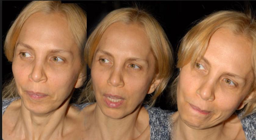 Sertab Erener: Şarkıcı burun estetiği yaptıramaz