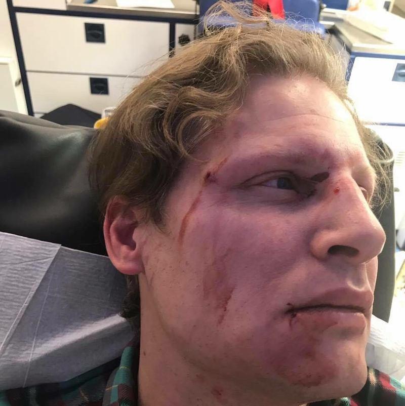 Terör örgütü PKK yandaşları Alman gazeteciye saldırdı