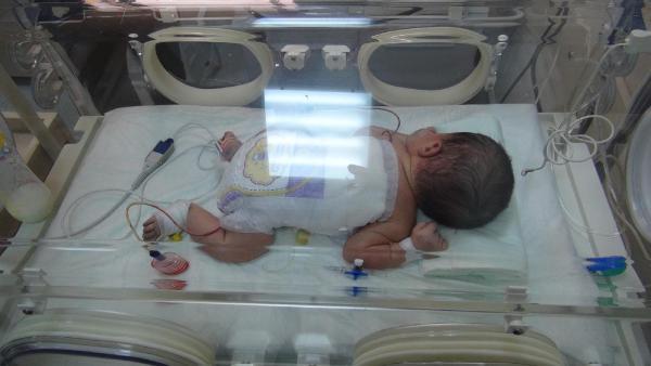 Yüksekova’da 3 saatlik bebeğe omirilik ameliyatı yapıldı