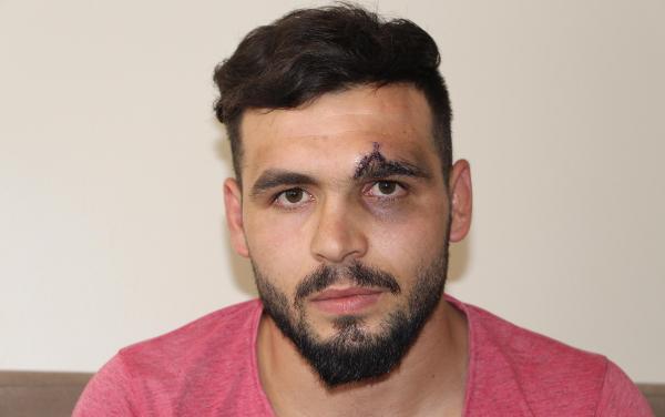 Düğünde şov yapmak isterken yere çakıldı