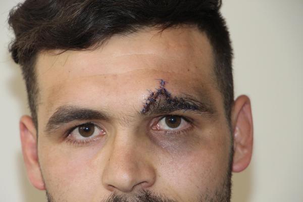 Düğünde şov yapmak isterken yere çakıldı