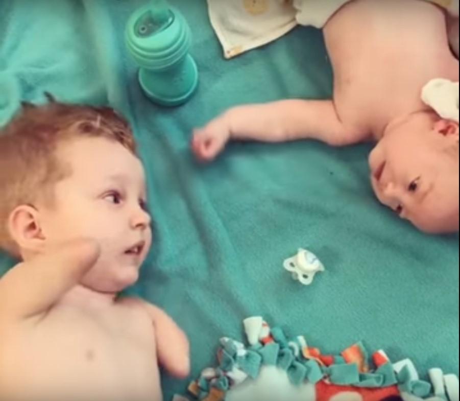 Kolları olmayan bebeğin kardeş sevgisi