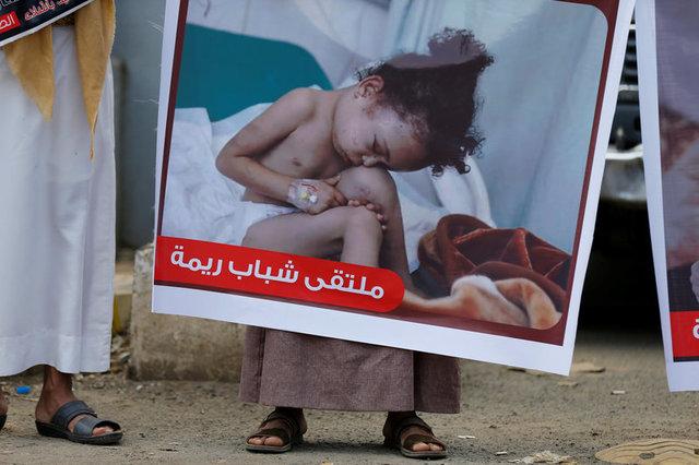 Yemen'de 380 bin çocuk açlıktan ölümle yüz yüze