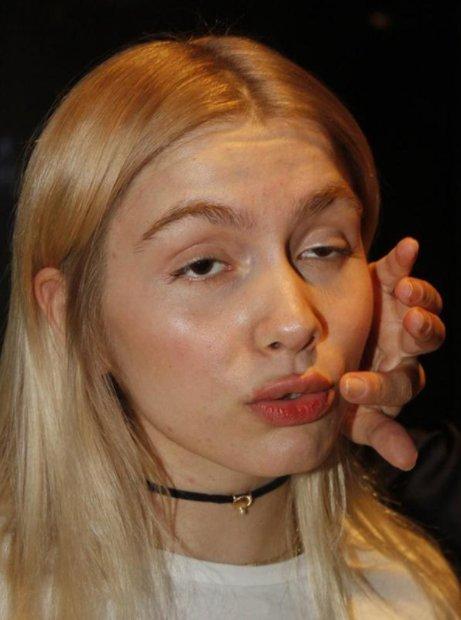 Aleyna Tilki'ye estetik sorusu