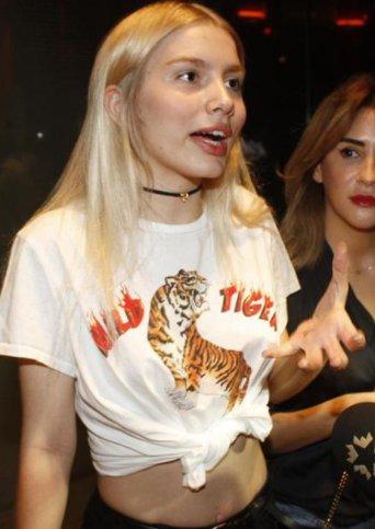 Aleyna Tilki'ye estetik sorusu